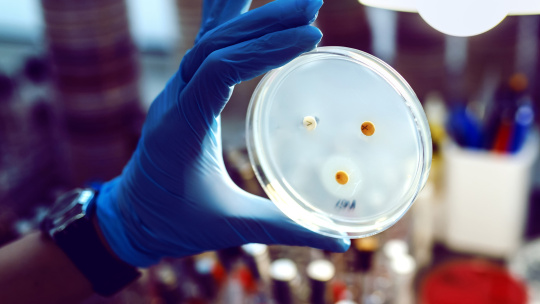 Une personne du laboratoire portant des gants bleus tient une boîte de Pétri.