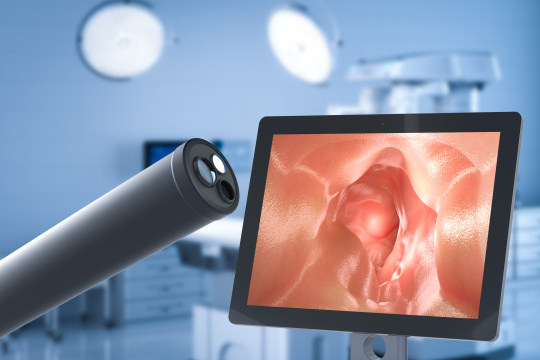 Endoscope avec capteurs à côté d'un écran qui montre l'intérieur du corps