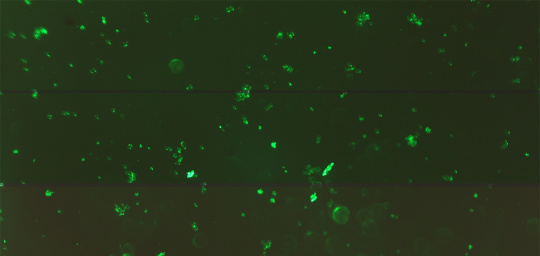 La caméra détecte les cellules humaines qui émettent une lumière verte différente selon le taux de sénescence